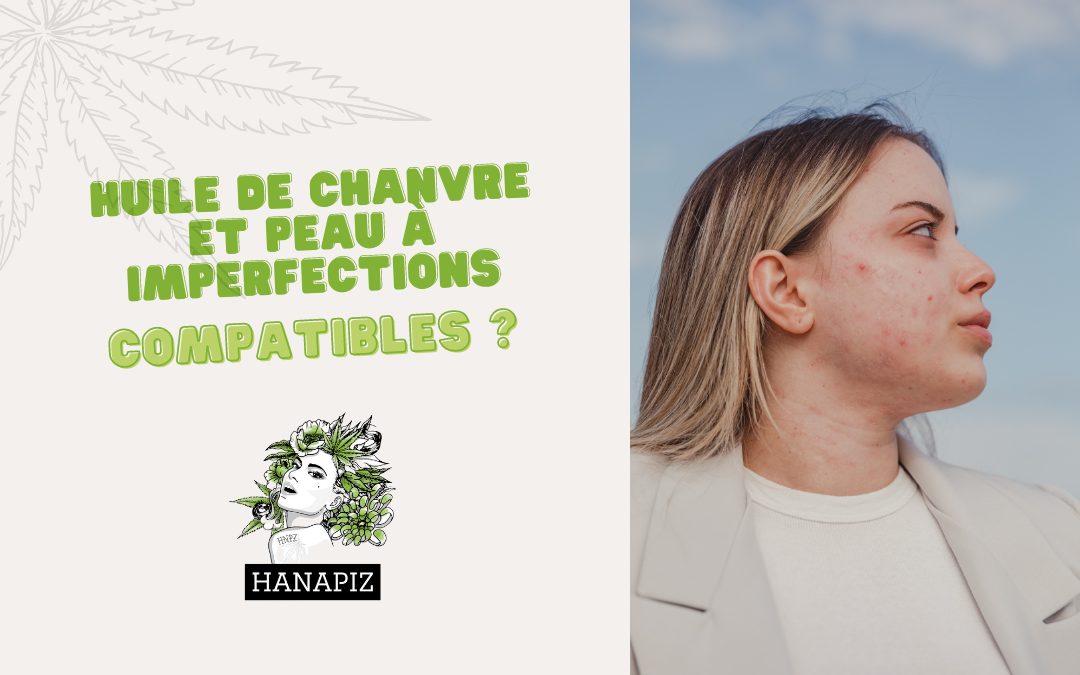 chanvre acne solutions